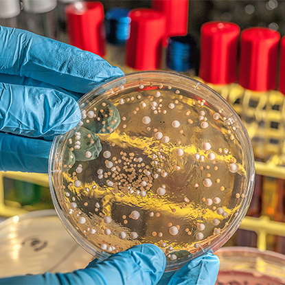 Sănătate și Controlul Bolilor